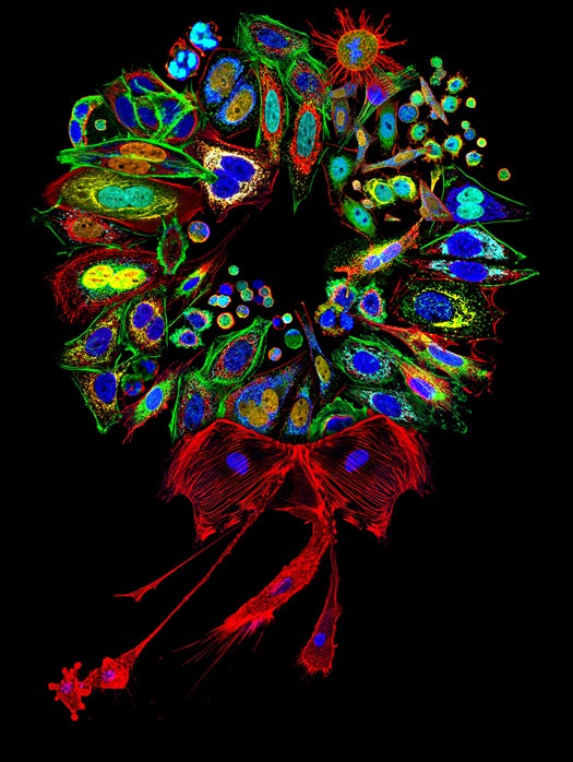 <strong>19th Place</strong> Dr. Donna Stolz of the University of Pittsburgha€¨ in Pittsburgh, Pennsylvania, USA won with this shot of mammalian cell collage stained for various proteins and organelles, assembled into a wreath, at 200-2000X magnification, using a single slice confocal cell mosaic.