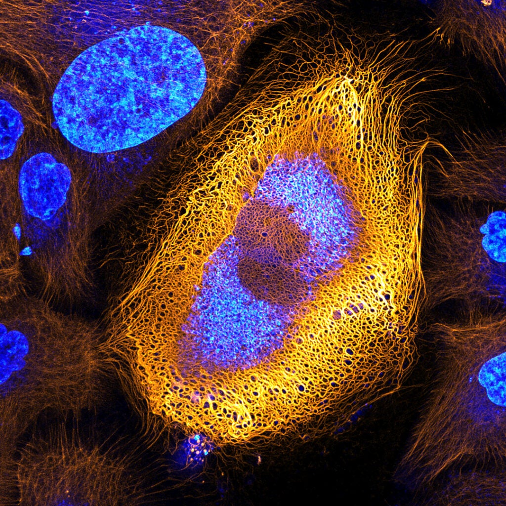 Skin cells with fluorescent keratin