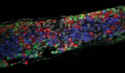 Researchers are encapsulating cells to make a donor pancreas that the immune system won't reject. Here, insulin-producing cells are marked with a fluorescent blue stain.