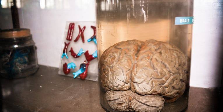 If you grow a brain in a lab, will it have a mind of its own?