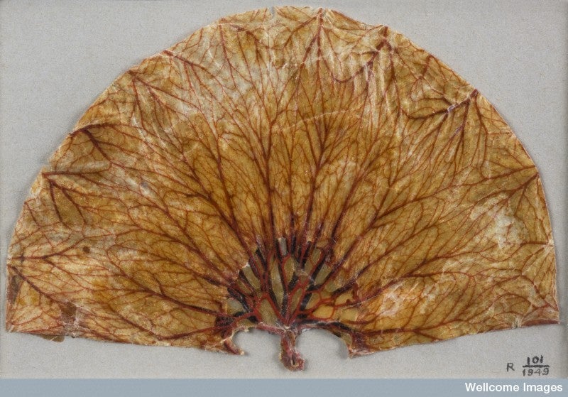 About 200 years ago (give or take a decade) the scientist and vaccine pioneer Edward Jenner flattened this section of a human stomach and pumped it with wax, probably to make it into a teaching tool for his medical students.