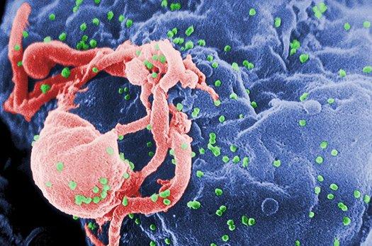 Body Scan Finds Secret Hiding Spots Of HIV-Like Virus In Monkeys