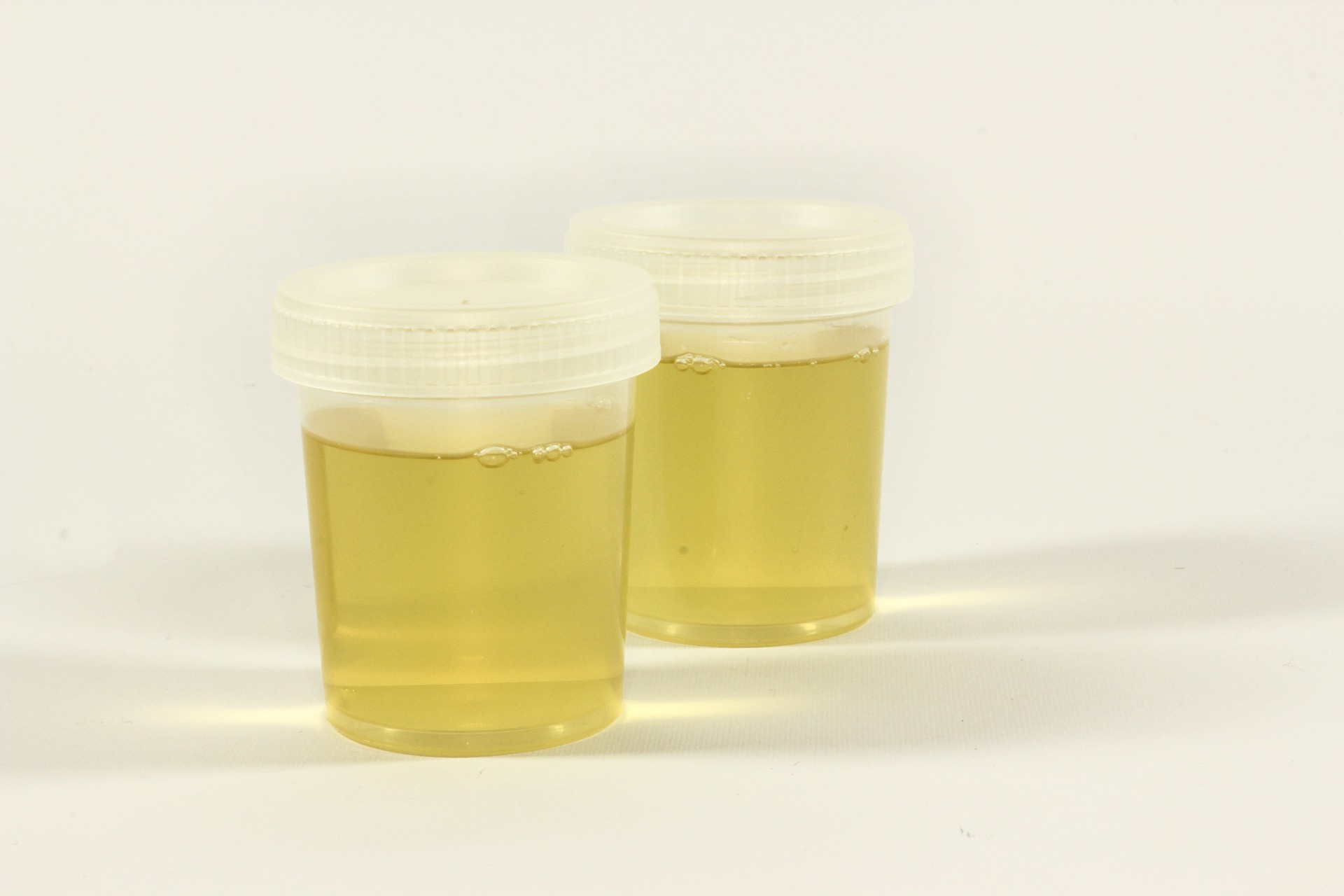 Is urine actually sterile?