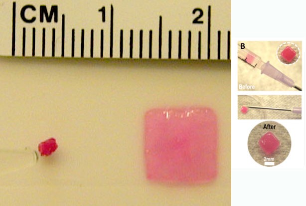 Injectable Sponges Can Expand Inside The Body To Deliver Drugs