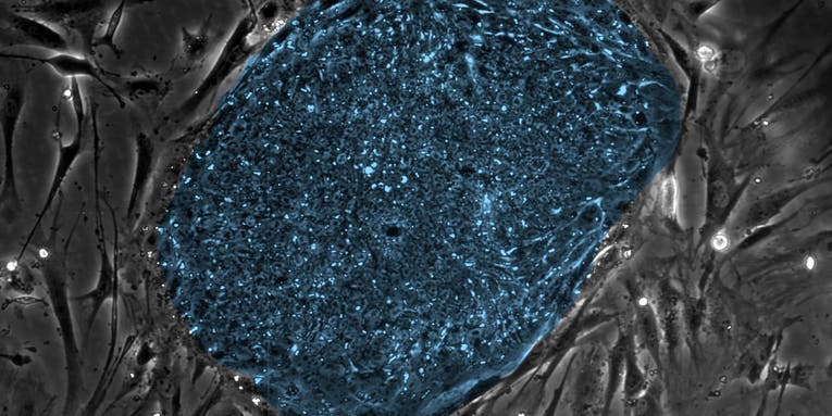 First Human Clone Embryos Created From Adults’ Skin Cells