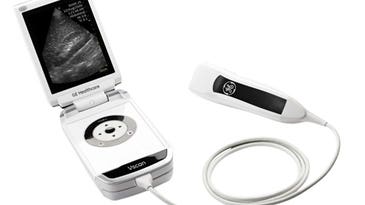 World’s Smallest Ultrasound Device Fits In Doc’s Coat Pocket