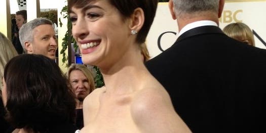 Someone Bothered To Look Up The Science Of Hating Anne Hathaway