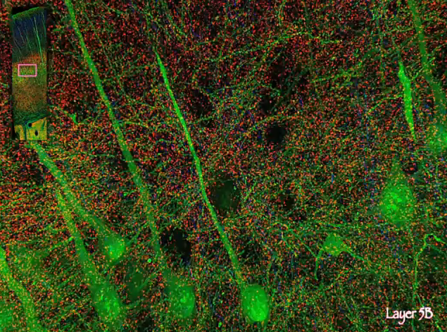 Video: 3-D Image Shows Brain’s Circuitry In Highest Resolution Ever