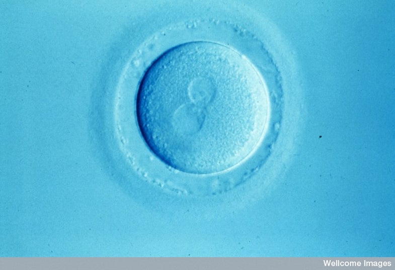 B0001451 Newly fertilised human egg Credit: Alan Handyside. Wellcome Images images@wellcome.ac.uk http://images.wellcome.ac.uk Human egg soon after fertilisation viewed using Nomarski optics. The two parental pronuclei are clearly visible and have not yet fused. Nomarski optics micrograph Published: - Copyrighted work available under Creative Commons by-nc-nd 2.0 UK, see http://images.wellcome.ac.uk/indexplus/page/Prices.html
