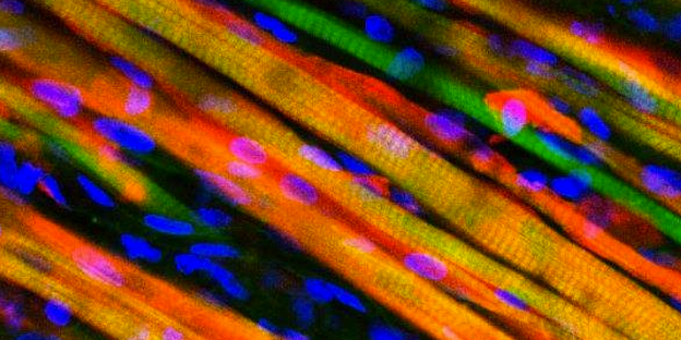 Self-Healing Muscles Grown In Lab, Implanted In Mice