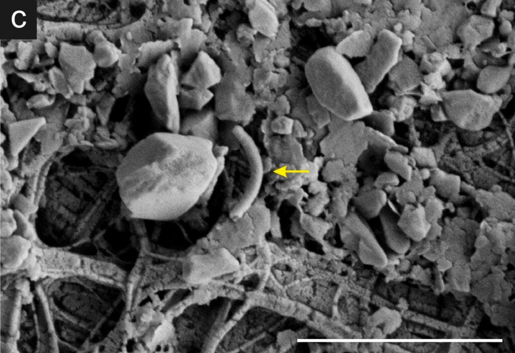 The yellow arrow points to a rod-shaped bacterium. The white scale bar represents 2 micrometers. This image was taken with a scanning electron microscope.