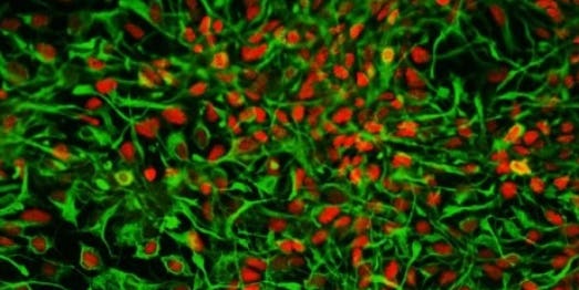 Science Can Now Turn Human Urine Into Brain Cells