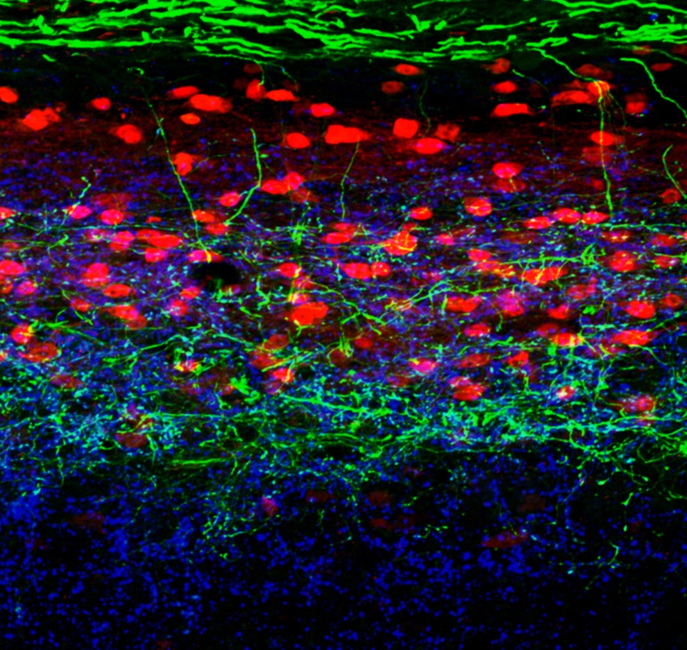 This is a cross-section of a mouse's spinal cord. Neurons with NPY protein, red, are tightly intermingled with neurons that send touch signals to the brain, in green.
