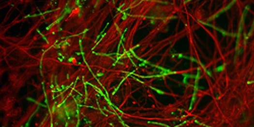 Mice Skin Cells Transformed Into Brain Cells