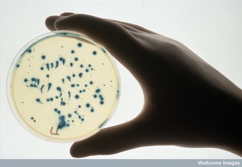 B0002430 Hand holding petri dish of recombinant organisms Credit: Audio Visual, LSHTM. Wellcome Images images@wellcome.ac.uk http://images.wellcome.ac.uk Hand wearing a latex glove and holding a petri dish of E. coli. The blue colour allows easy selection of recombinant plasmids. The blue colonies contain the parental plasmid which has a gene for the beta- galactosidase protein incorporated into it. This converts a substrate to the blue dye. If an extra piece of DNA is inserted into the plasmid (a recombinant plasmid) this enzyme is disrupted and no blue dye is produed and the colony appears white. Published: - Copyrighted work available under Creative Commons by-nc-nd 2.0 UK, see http://images.wellcome.ac.uk/indexplus/page/Prices.html