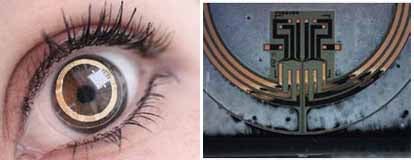 A circular strain gauge in the contact lens detects changes in the diameter of the eye. The tiny microelectromechanical systems chip then reads the data and transmits the information wirelessly to an external receiver worn around the patient's neck.
