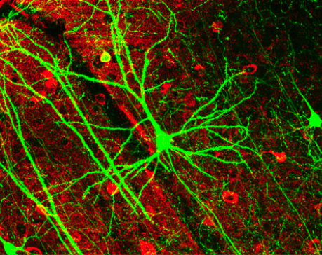 Artificial Neurons Could Replace Some Real Ones In Your Brain