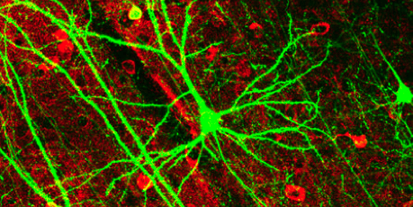 Artificial Neurons Could Replace Some Real Ones In Your Brain