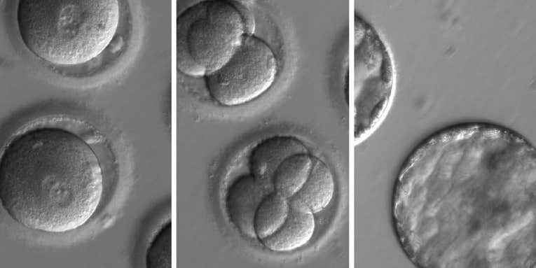 U.S. researchers have used gene editing to combat heart disease in human embryos