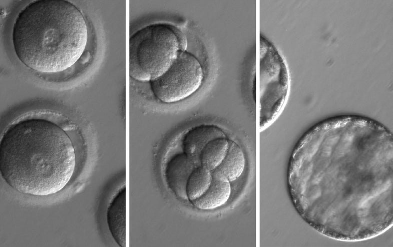 This sequence of images shows the development of embryos after co-injection of a gene-correcting enzyme and sperm from a donor with a genetic mutation known to cause hypertrophic cardiomyopathy. A new study, published today in the journal Nature, demonstrates an effective method of repairing a disease-causing mutation from the moment of fertilization, preventing it from being passed to future generations. (OHSU)