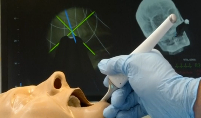 Handheld Device For Surgeons Could Turn Off Pain