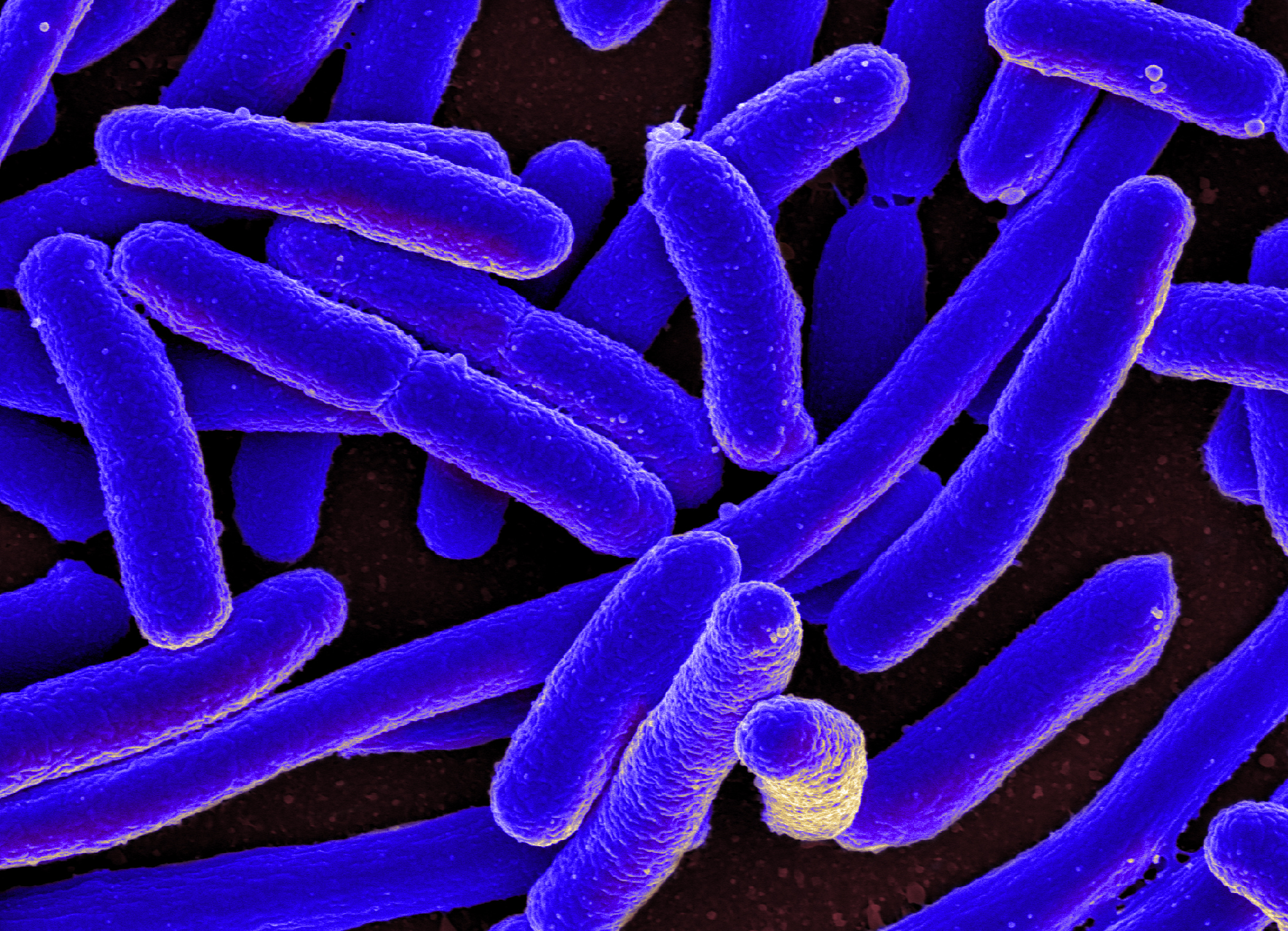 A warmer planet might make deadly bacteria more resistant to antibiotics