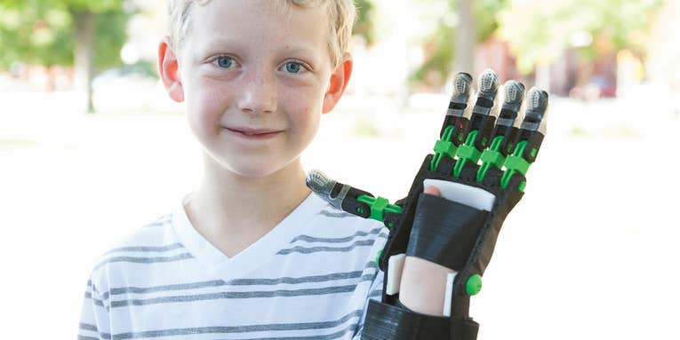 Makers Print Out Durable, Custom Prosthetic Hands For Needy Kids
