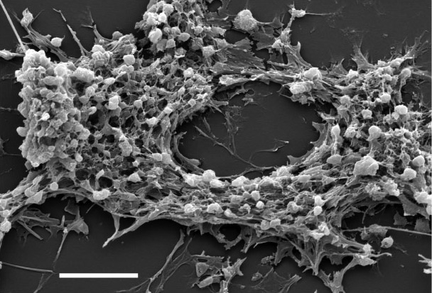 Drugs Disguised As Blood Cells Could Kill Cancer