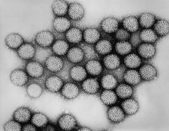 How an otherwise harmless virus can trigger celiac disease