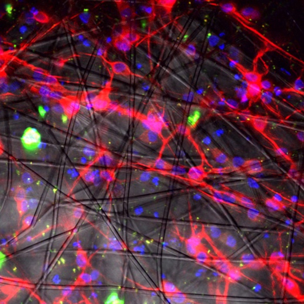 Lab Grown Neuron Networks Could Treat Parkinson’s, Alzheimer’s