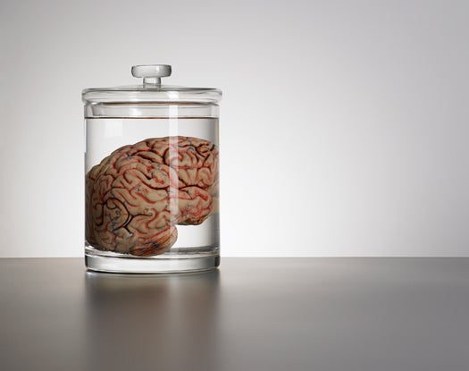 brain in speciman jar