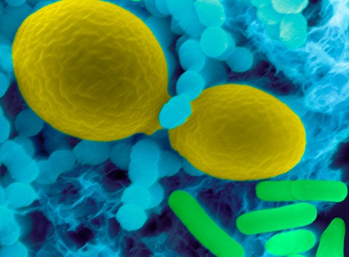 Ordinary <em>S. mutans</em> [above right, in blue] lives in the mouth along with yeast [yellow] and <em>P. gingivalis</em> bacteria [green].