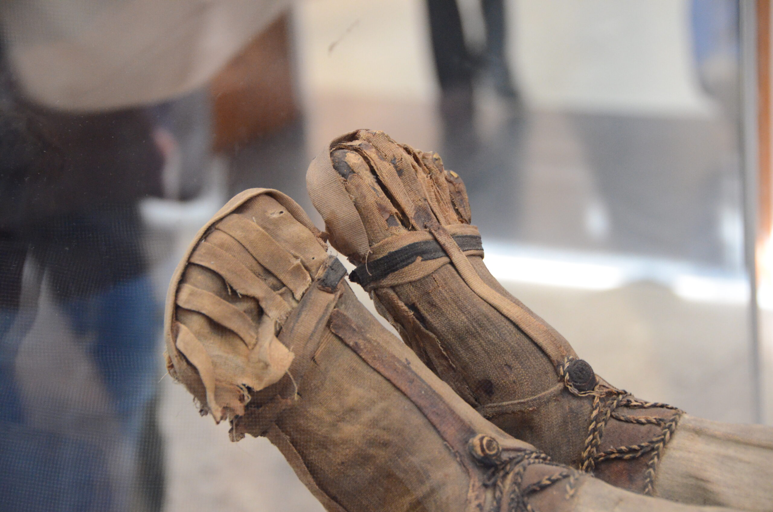 Scientists Just Made A Brand-New Ancient Human Mummy Leg