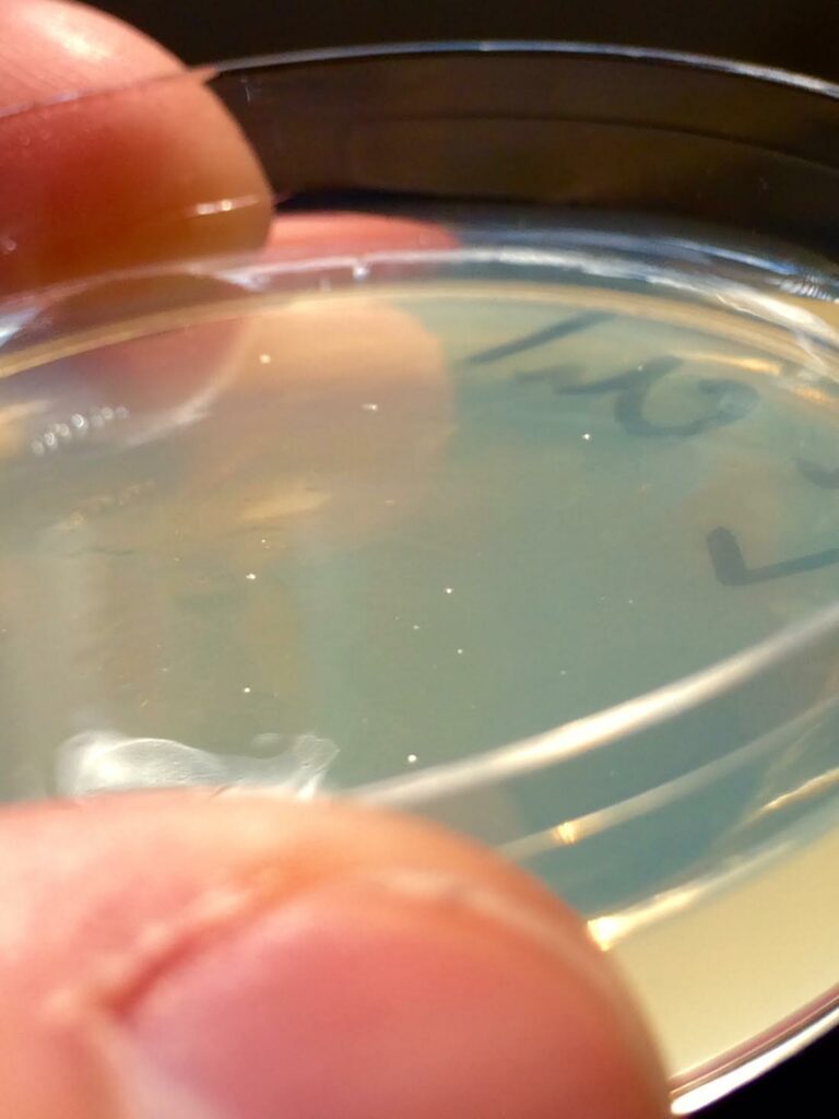 Escherichia coli with genes for red and blue fluorescence