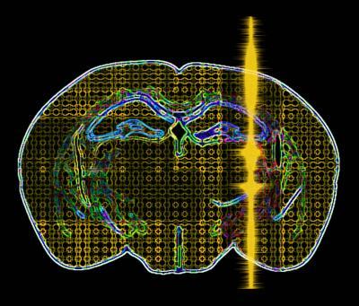 Noninvasive Ultrasound Pulses Could Treat Neuro Disorders, Enhance Cognitive Function