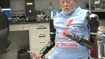 World First: Man Controls Two Prosthetic Arms With His Mind