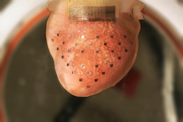 This Pacemaker Membrane Can Keep A Heart Beating Perfectly