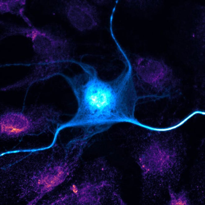 Blue neuron