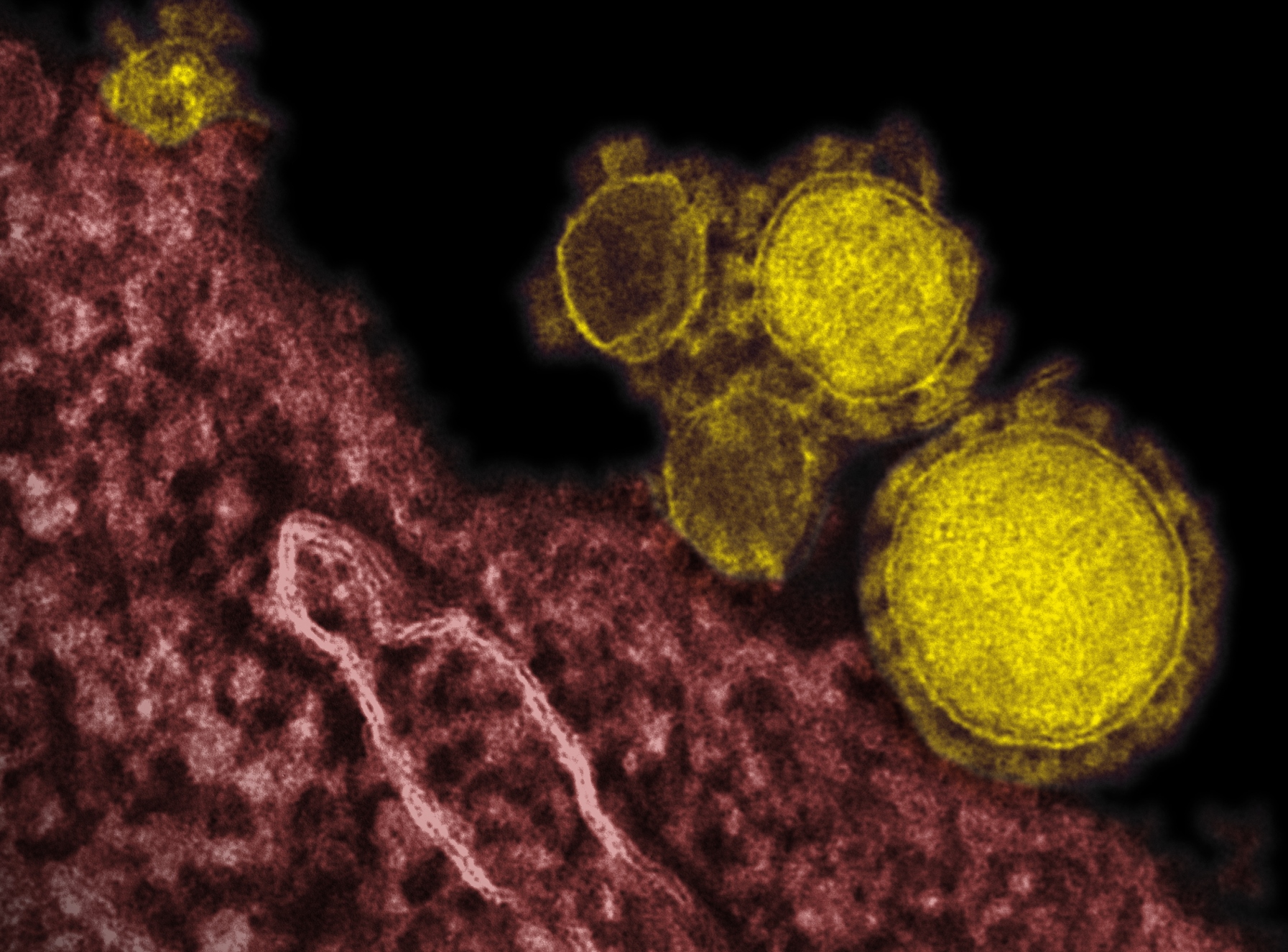 Solving Another MERS Mystery