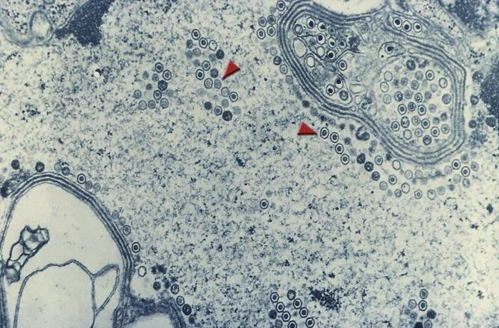 In this transmission electron micrograph image of a cell, red arrows point to herpes simplex viruses inside the cell.