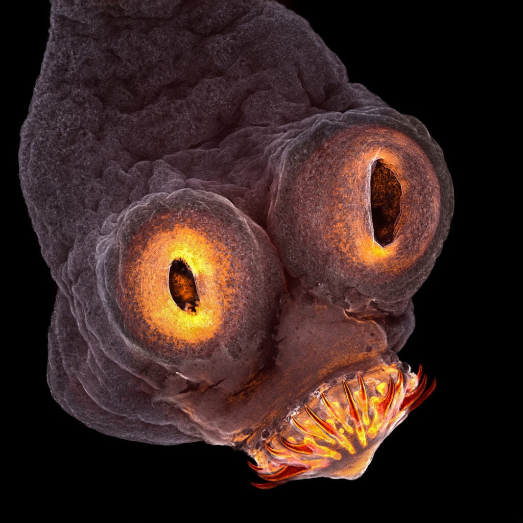 The front end of a tapeworm