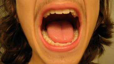 What To Make Of That Saliva Test For Homosexuality