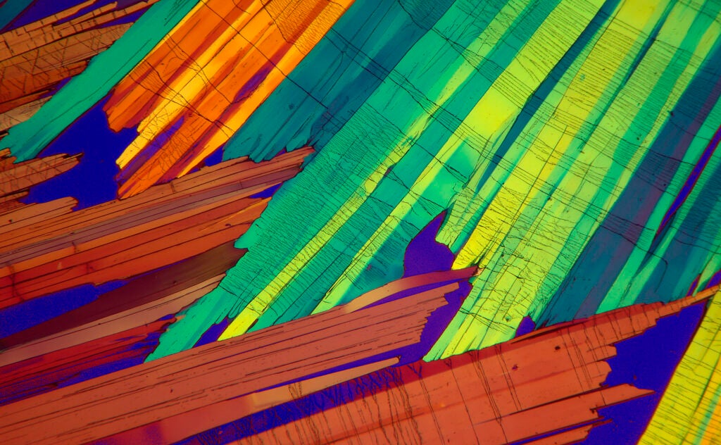 Gallery: This Year&#8217;s Most Amazing Microscopic Photography