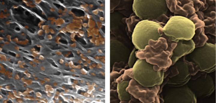 Nanoparticles Disguised As Blood Cells Could Destroy Diseases