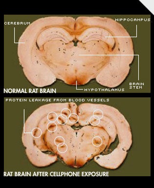 CAN YOU HEAR ME NOW?<br />
Researchers at Sweden's Lund University say these rat-brain cross-sections show first-ever evidence of brain damage from cellphone radiation. While the controls (example, top) appear healthy, the test subjects (bottom), which were exposed to a 2-hour dose of cellphone radiation of varying intensities, are heavily spotted with proteins (dark patches) leaked from surrounding blood vessels, and show signs of significant neuronal damage.