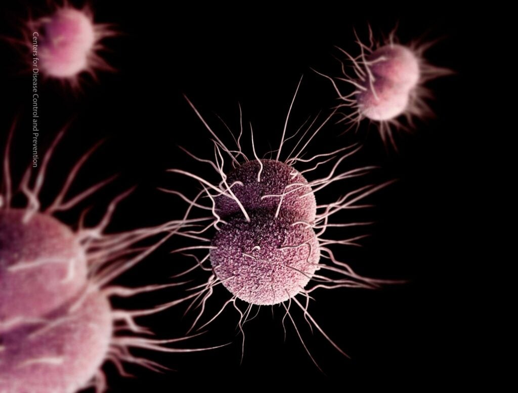 Antibiotic-resistant gonorrhea is a huge problem, and it&#8217;s only getting worse
