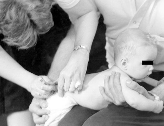 An infant gets immunized in this undated historical photo. American doctors no longer use so-called "gluteal injection sites" for immunizations.