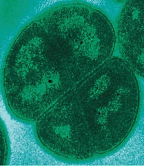 Deinococcus radiodurans bacteria