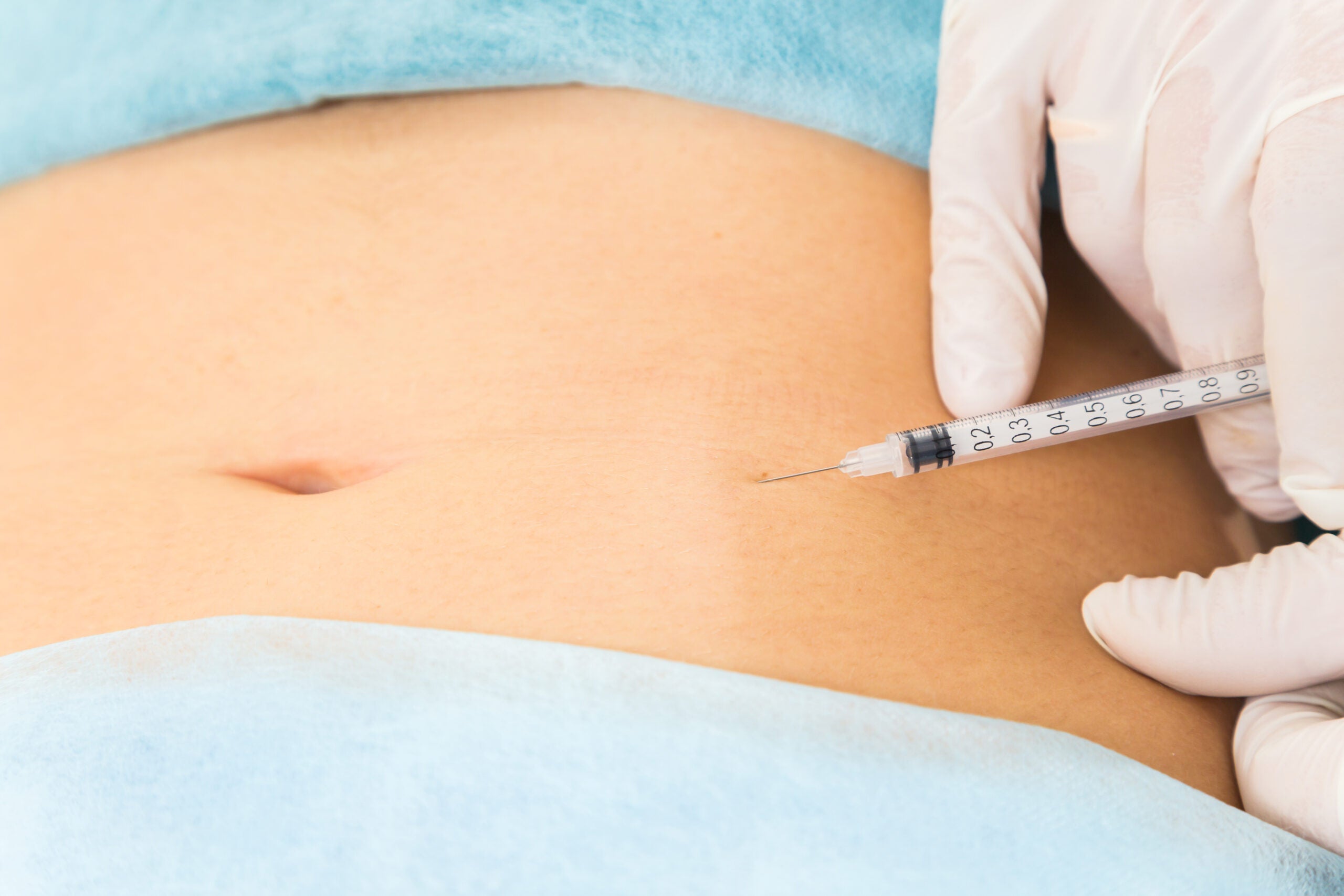 Carbon dioxide injections might seem better than liposuction—but there’s a catch
