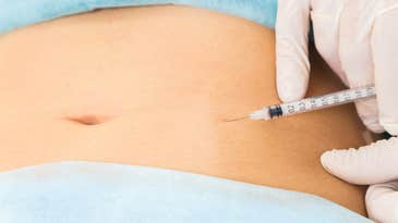 Carbon dioxide injections might seem better than liposuction—but there’s a catch
